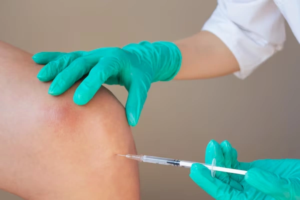 Joint Injections