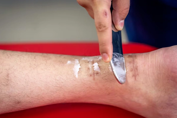 Advanced Wound Care